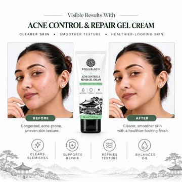 Acne Control & Repair Gel Cream(50ML)